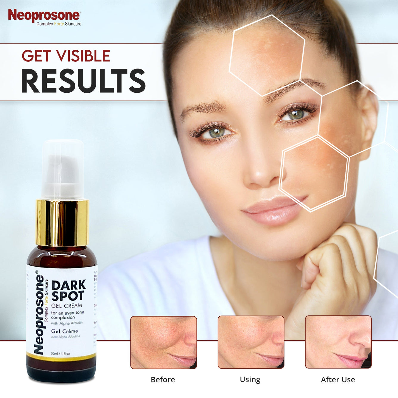 Neoprosone Dark Spot Remover Gel Cream - 1 Fl oz / 30ml Mitchell Brands - Mitchell Brands - Skin Lightening, Skin Brightening, Fade Dark Spots, Shea Butter, Hair Growth Products